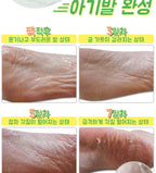 Elizavecca Witch Piggy Hell Pore Turtle’s Foot Pack – Exfoliating Foot Peel Socks for Baby-Soft, Smooth Heels